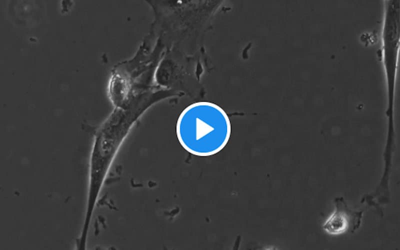 Image of Mesenchymal Stem Cells
